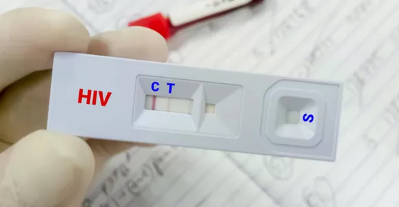 alligator clips for ecg machine