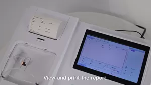 bc300-semi-auto-biochemistry-analyzer-15.jpg bc300-semi-auto-biochemistry-analyzer-15.jpg