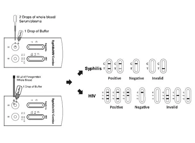 box of medical gloves