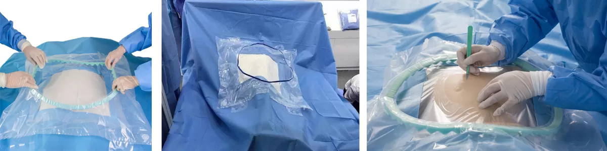 Steps for Using a C-section Pack