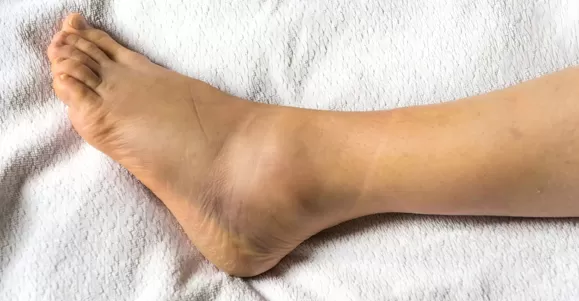 catheter mount for ventilator