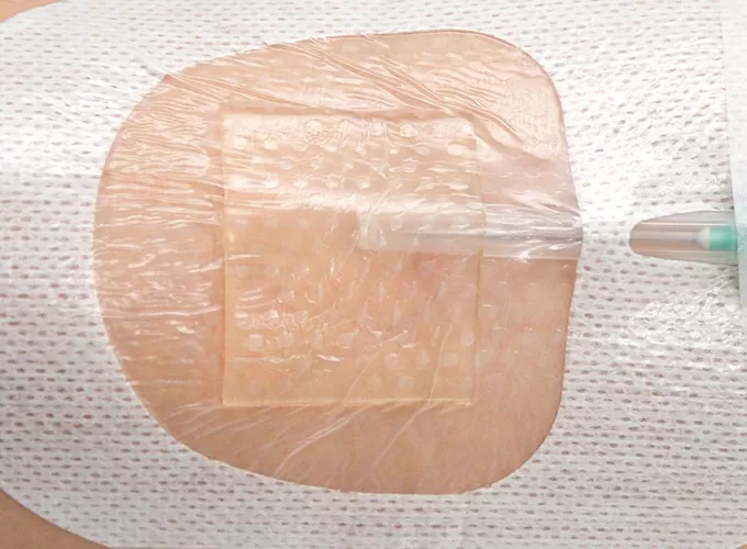 chg dressing supplier