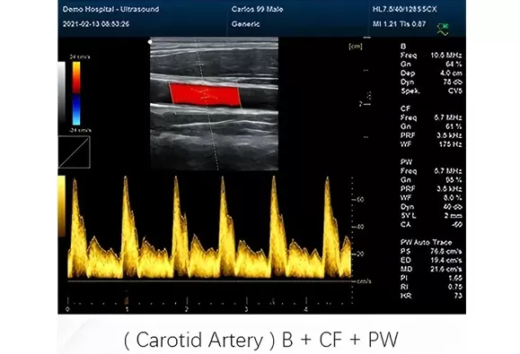 Excellent portability