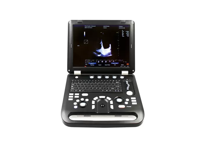 cms1700c vet veterinary ultrasound in china