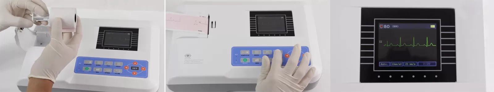 Steps for Using a ECG100G-VET Electrocardiograph