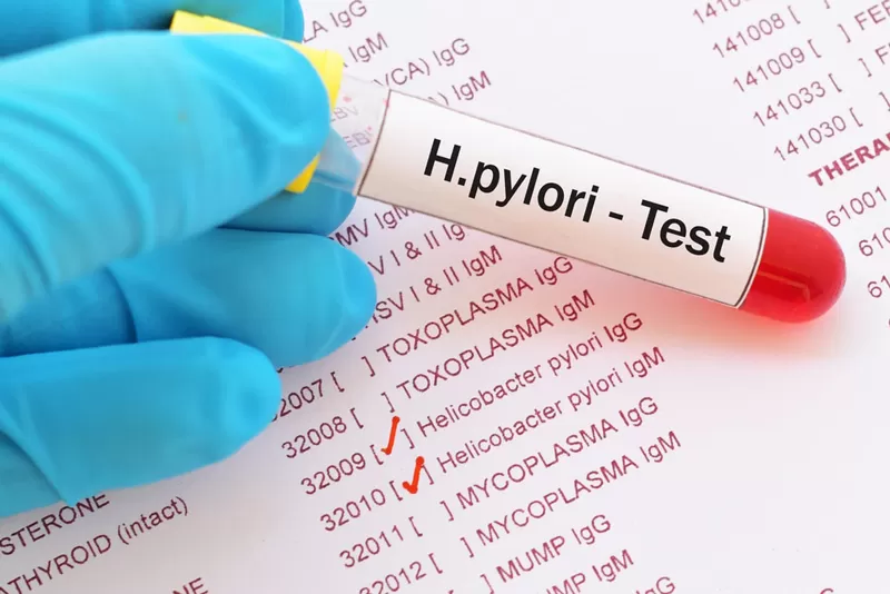 h-pylori-test-8.jpg h-pylori-test-8.jpg