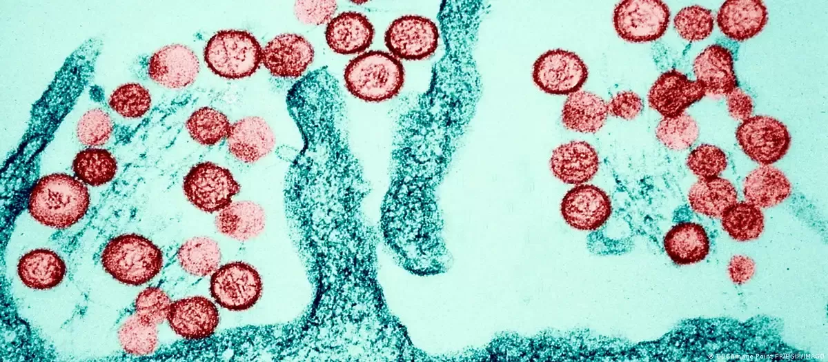hantavirus-under-a-microscope.jpg hantavirus-under-a-microscope.jpg