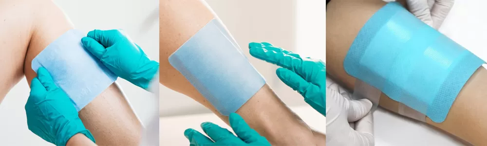 Steps for Using a Super Absorbent Dressing Steps for Using a Super Absorbent Dressing