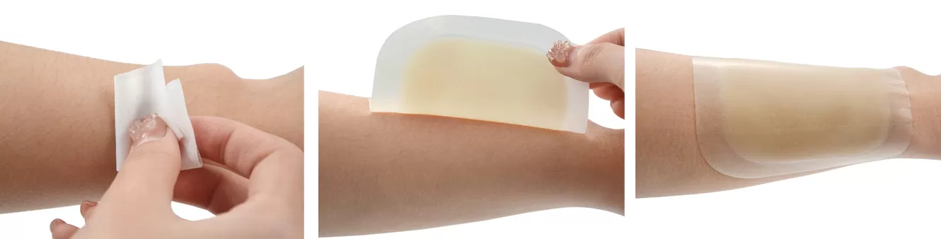 hydrocolloid-dressing-19.jpg
