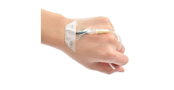 Indications of I.V. Dressing