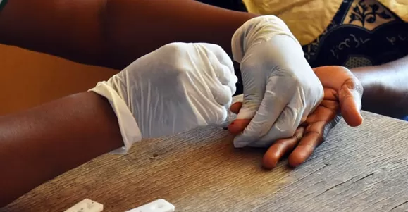 Application of Malaria Test