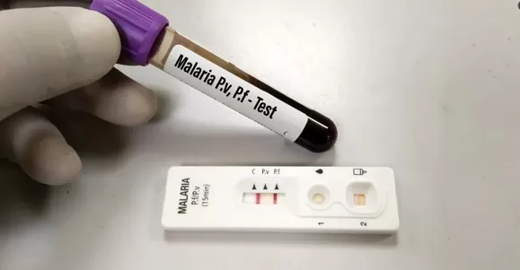 Application of Malaria Test