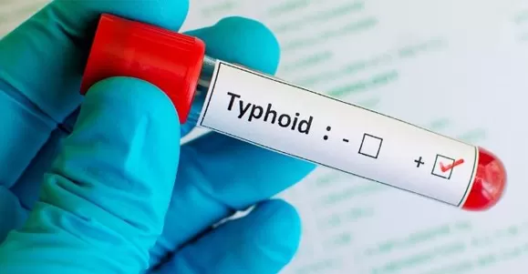 medicated gauze for wounds