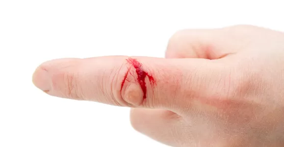 Indication of PHMB Dressing