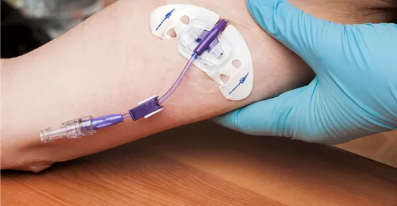 Applications of Silver Dressing