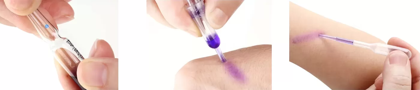 Steps for Using a Tissue Adhesive