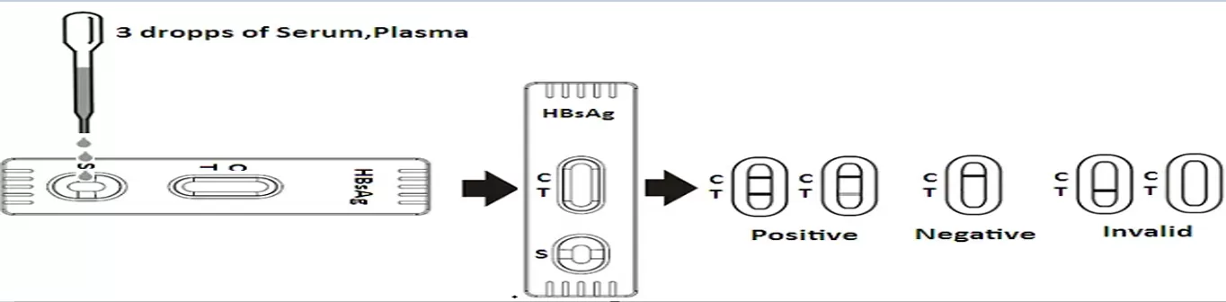Steps for Using a HBsAg Test Steps for Using a HBsAg Test