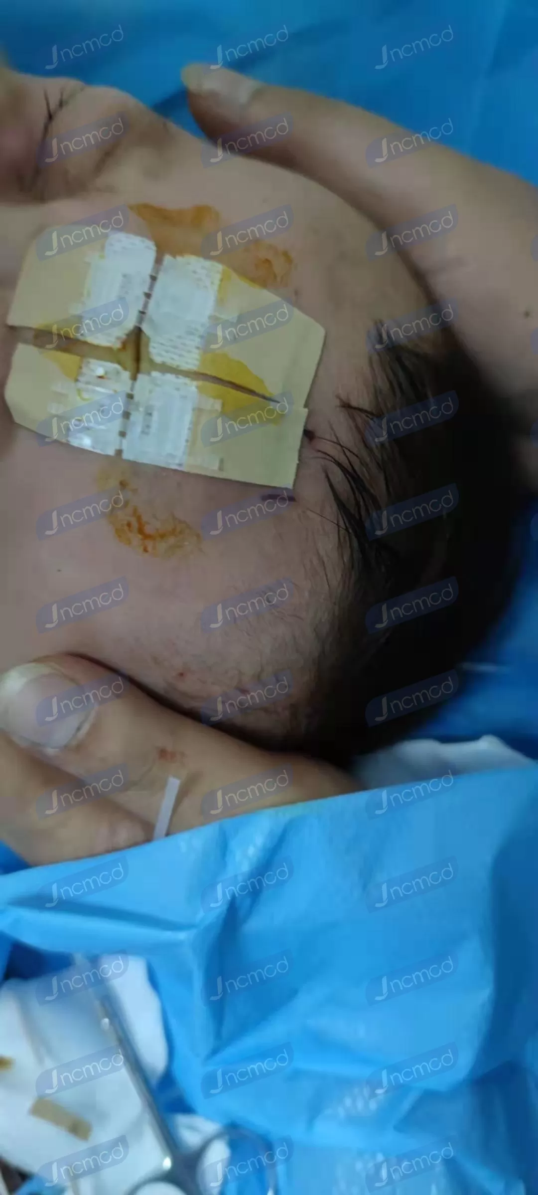 surgical kit for feline spay.jpg