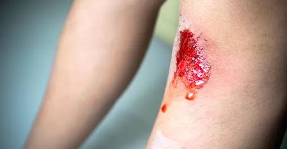 vaseline gauze dressing exporter