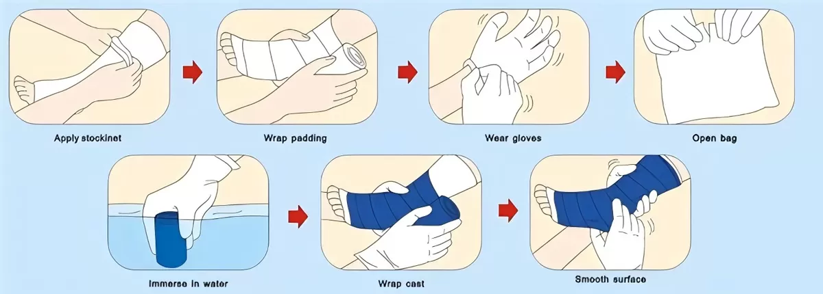 wrap-conforming-gauze-roll.jpg